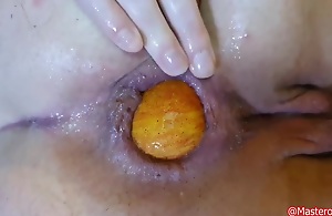Preview - Extreme Anal And Prolapse